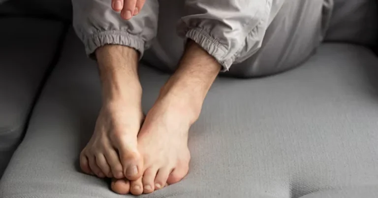 what does sickled feet mean
